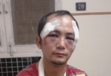 MSAD condemns the racial attack on Lal Bruce Thangkhal